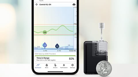 tandem insulin pump